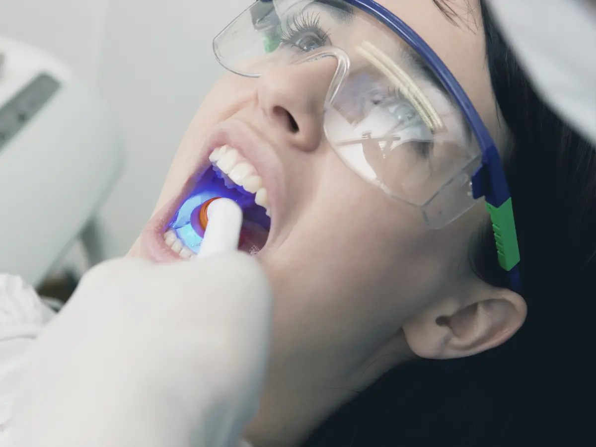 dental bonding and contouring at holly dental associates in centennial, co (1)