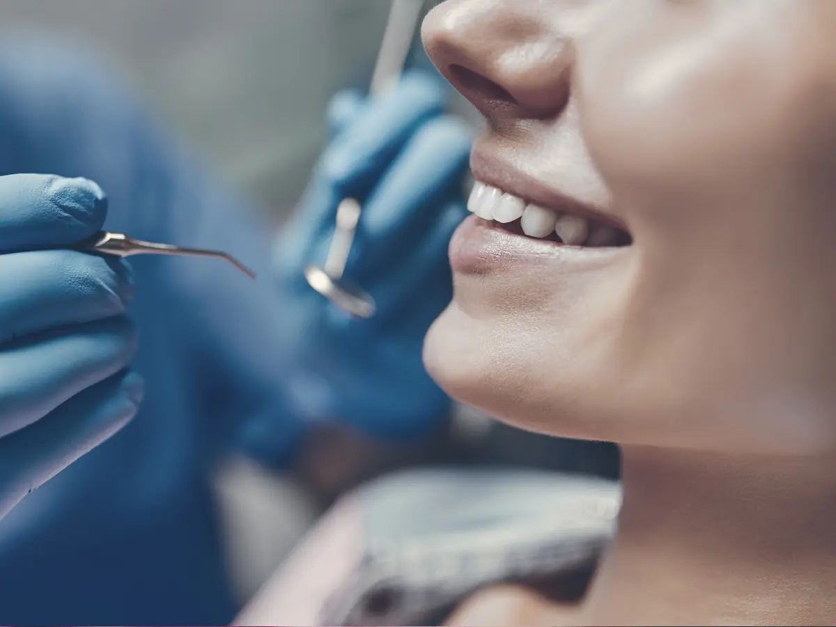 dental bonding at holly dental associates in centennial, co